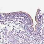 Immunohistochemical staining of human bronchus shows strong positivity in cilia of glandular cells.