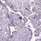 Immunohistochemical staining of human placenta shows no positivity in trophoblastic cells as expected.