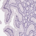 Immunohistochemical staining of human stomach shows no positivity in glandular cells as expected.