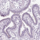 Immunohistochemical staining of human fallopian tube shows moderate positivity in cilia of glandular cells.