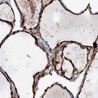 Anti-AFAP1L2 Antibody
