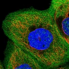 Immunofluorescent staining of human cell line A-431 shows localization to plasma membrane & cytosol.