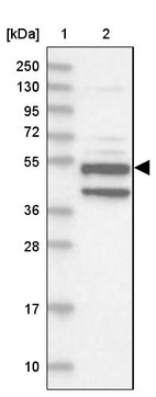 Lane 1: Marker [kDa] 250, 130, 95, 72, 55, 36, 28, 17, 10_br/_Lane 2: Human cell line RT-4