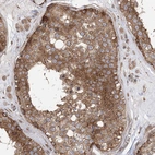 Anti-C12orf4 Antibody