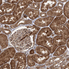 Immunohistochemical staining of human kidney shows strong cytoplasmic positivity in cells in tubules.