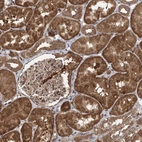 Immunohistochemical staining of human kidney shows strong cytoplasmic positivity in cells in tubules.