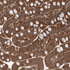 Immunohistochemical staining of human small intestine shows strong cytoplasmic positivity in glandular cells.