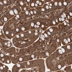 Immunohistochemical staining of human small intestine shows strong cytoplasmic positivity in glandular cells.
