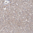 Immunohistochemical staining of human liver shows very weak cytoplasmic positivity in hepatocytes.
