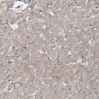 Immunohistochemical staining of human liver shows very weak cytoplasmic positivity in hepatocytes.