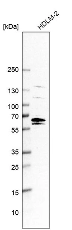 Western blot analysis in human cell line HDLM-2.