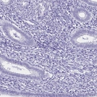 Immunohistochemical staining of human endometrium shows low expression as expected.