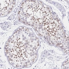 Immunohistochemical staining of human testis shows high expression.