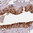 Immunohistochemical staining of human bronchus shows strong cytoplasmic positivity in respiratory epithelial cells.