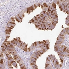 Immunohistochemical staining of human fallopian tube shows strong cytoplasmic positivity in glandular cells.
