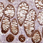 Anti-PRDX5 Antibody