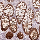 Immunohistochemical staining of human rectum shows strong cytoplasmic positivity in glandular cells.
