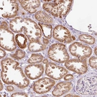 Immunohistochemical staining of human kidney shows strong cytoplasmic positivity in cells in tubules.
