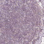 Anti-PRDX5 Antibody