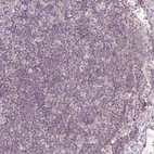 Immunohistochemical staining of human lymph node shows negative to very weak cytoplasmic positivity in non-germinal center cells.