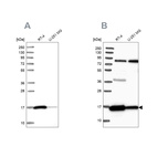 Anti-PRDX5 Antibody