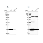 Western blot analysis using Anti-PRDX5 antibody HPA037915 (A) shows similar pattern to independent antibody HPA037916 (B).