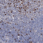 Anti-ANKRD16 Antibody
