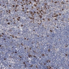 Anti-ANKRD16 Antibody