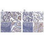 Anti-RTKN2 Antibody