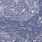 Immunohistochemical staining of human lymph node using Anti-RTKN2 antibody HPA037946.