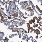 Immunohistochemical staining of human lung using Anti-RTKN2 antibody HPA037946.