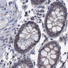 Immunohistochemical staining of human colon using Anti-RTKN2 antibody HPA037946.