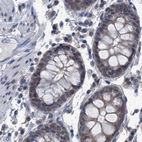 Immunohistochemical staining of human colon using Anti-RTKN2 antibody HPA037946.