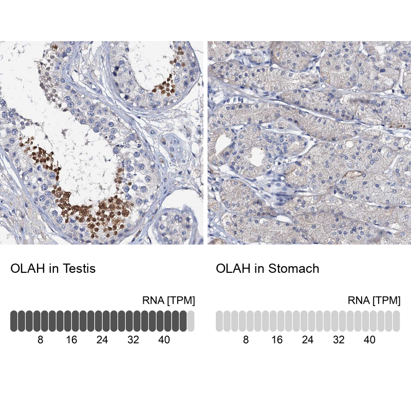 Anti-OLAH Antibody