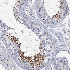 Immunohistochemical staining of human testis shows high expression.