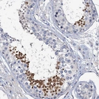 Immunohistochemical staining of human testis shows high expression.