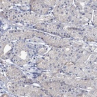 Immunohistochemical staining of human stomach shows low expression as expected.