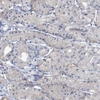 Immunohistochemical staining of human stomach shows low expression as expected.