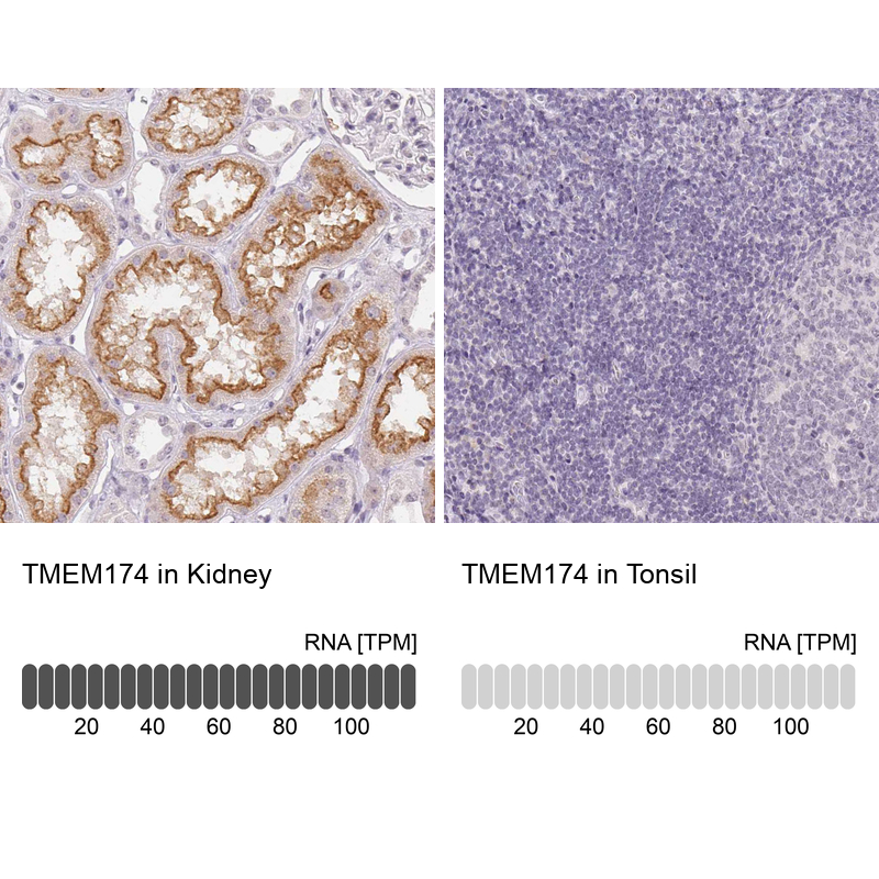 Anti-TMEM174 Antibody
