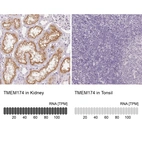 Anti-TMEM174 Antibody