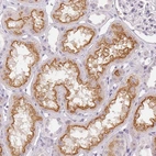 Immunohistochemical staining of human kidney shows strong granular cytoplasmic positivity in cells in tubules.