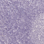 Anti-TMEM174 Antibody