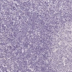 Immunohistochemical staining of human tonsil shows no positivity in non-germinal center cells as expected.