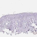 Immunohistochemical staining of human skin shows no positivity in squamous epithelial cells as expected.