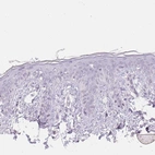 Immunohistochemical staining of human skin shows no positivity in squamous epithelial cells as expected.