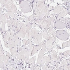 Immunohistochemical staining of human skeletal muscle shows no positivity in myocytes as expected.