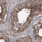 Immunohistochemical staining of human testis shows strong membranous positivity in cells in seminiferous ducts.