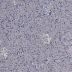 Immunohistochemical staining of human pancreas shows no positivity in exocrine glandular cells as expected.