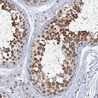 Anti-METTL14 Antibody