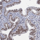 Immunohistochemical staining of human fallopian tube shows strong nuclear positivity in glandular cells.